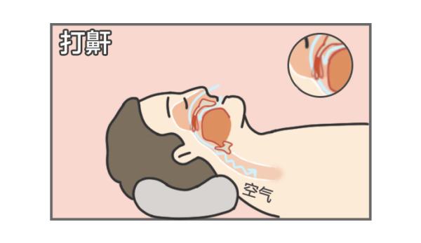 图片[4]-怎样的人容易打呼噜？这是一篇有声音的文章-万荀网